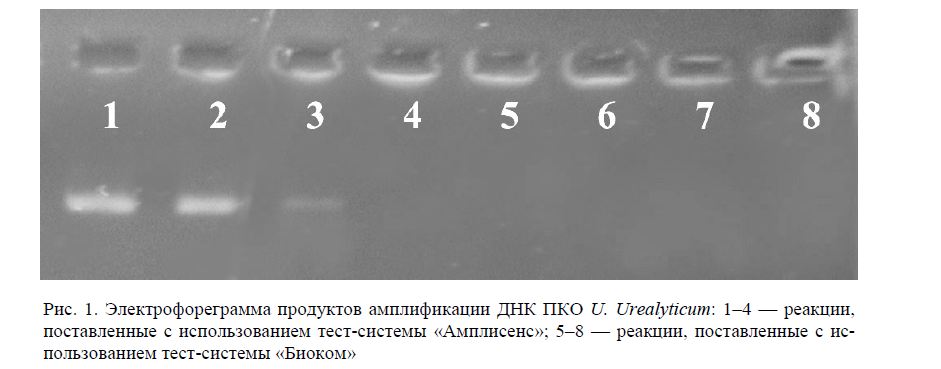 Электрофореграмма продуктов амплификации ДНК ПКО U. Urealyticum: 1–4 — реакции, поставленные с использованием тест-системы «Амплисенс»; 5–8 — реакции, поставленные с ис- пользованием тест-системы «Биоком»