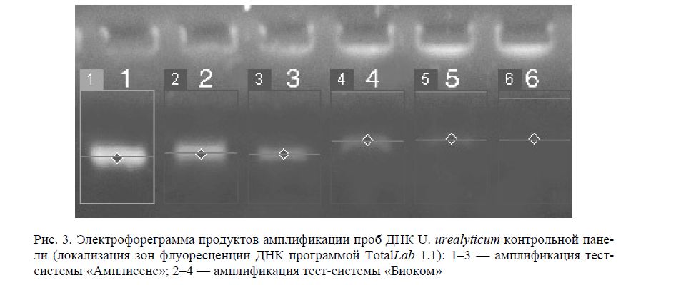 Электрофореграмма продуктов амплификации проб ДНК U. urealyticum контрольной пане- ли (локализация зон флуоресценции ДНК программой TotalLab 1.1): 1–3 — амплификация тест- системы «Амплисенс»; 2–4 — амплификация тест-системы «Биоком»