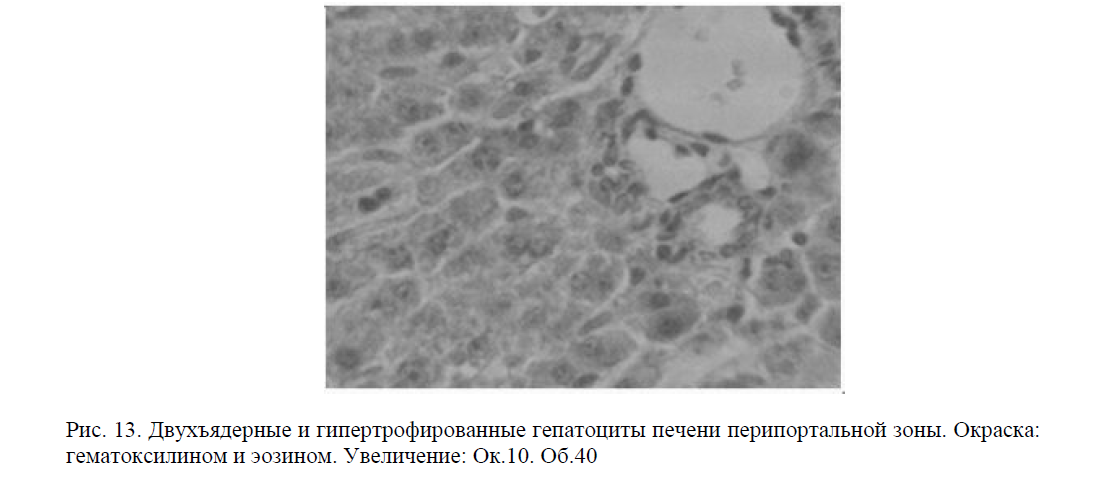 Двухъядерные и гипертрофированные гепатоциты печени перипортальной зоны. Окраска: гематоксилином и эозином. Увеличение: Ок.10. Об.40 