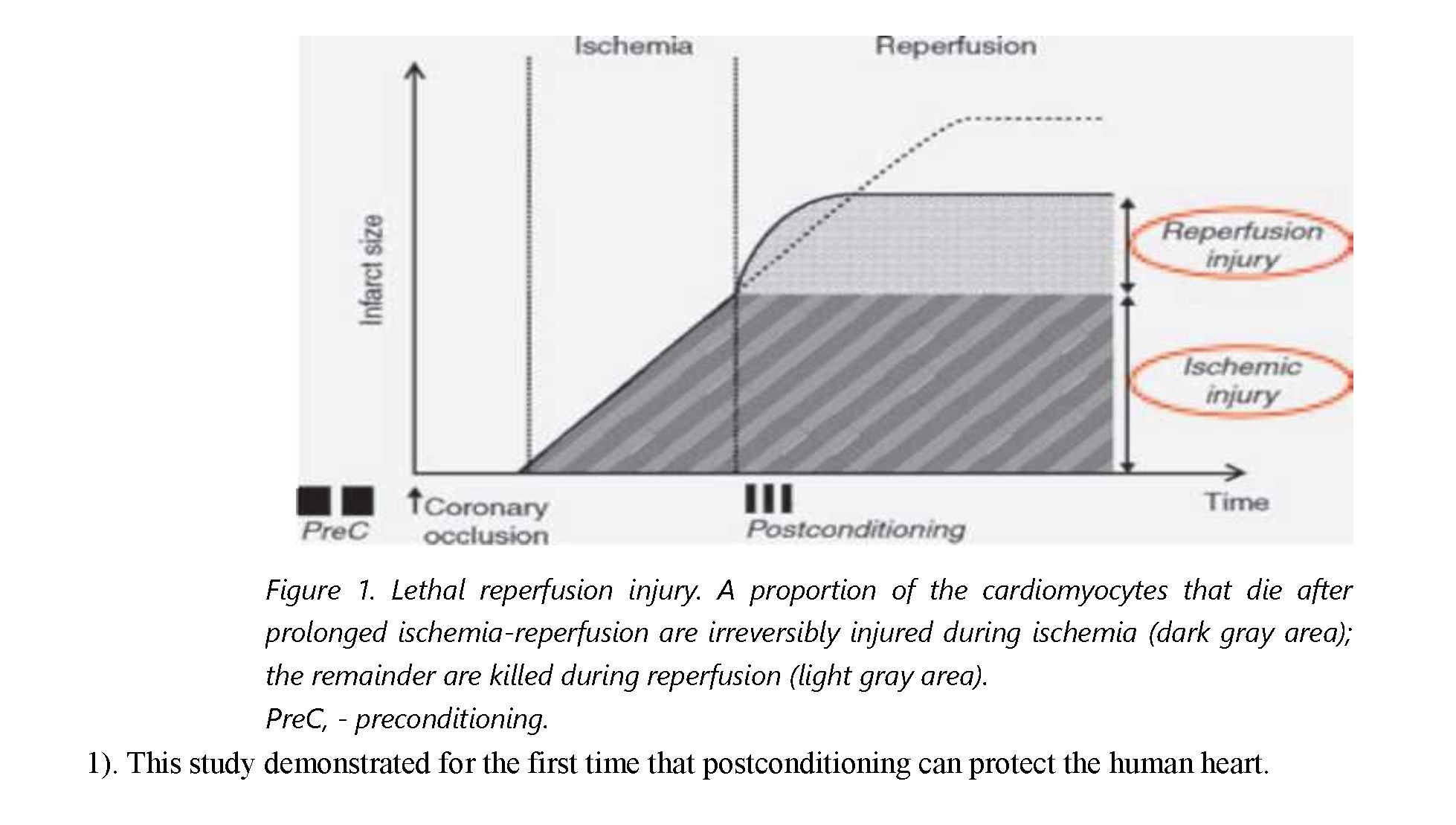 Protective features of postconditioning for the human heart