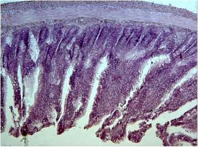 Goblet cells, swelling of the large intestine