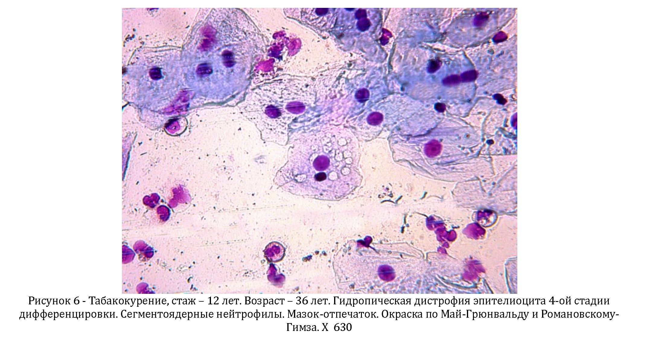 Клетки плоского эпителия полости рта человека под микроскопом