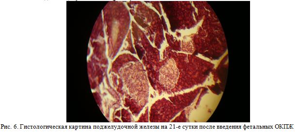 Гистологическая картина поджелудочной железы на 14-е сутки после введения фетальных ОКПЖ