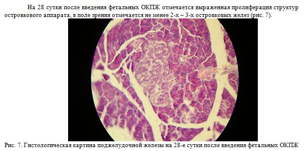 Гистологическая картина поджелудочной железы на 28-е сутки после введения фетальных ОКПЖ
