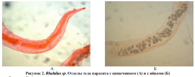 Кишечник лягушки озерной с внутриполостным паразитом. Окраска по Массону. Ув. х 200