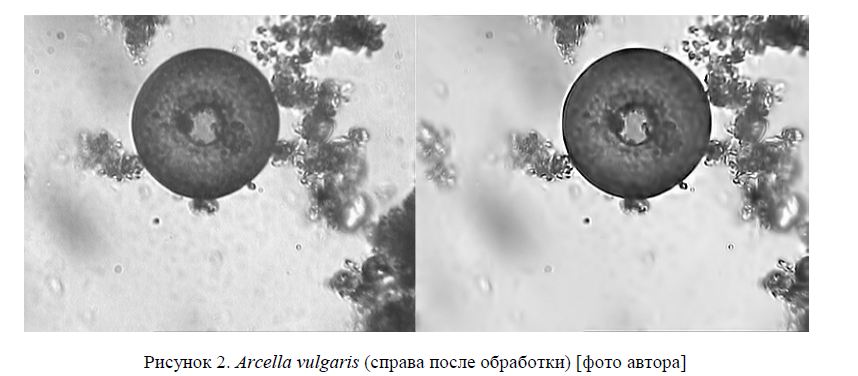 Arcella vulgaris