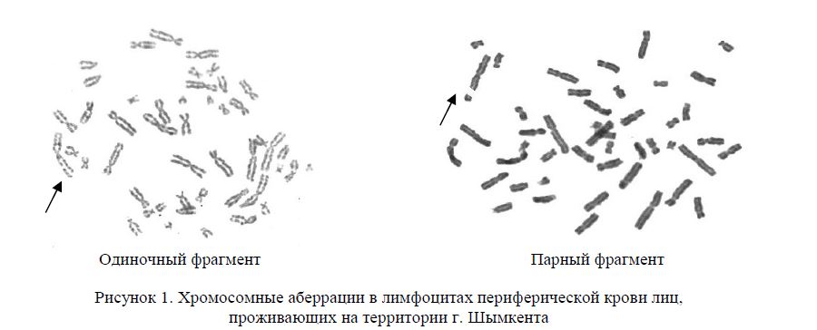 Хромосомные аберрации в лимфоцитах периферической крови лиц, проживающих на территории г. Шымкента