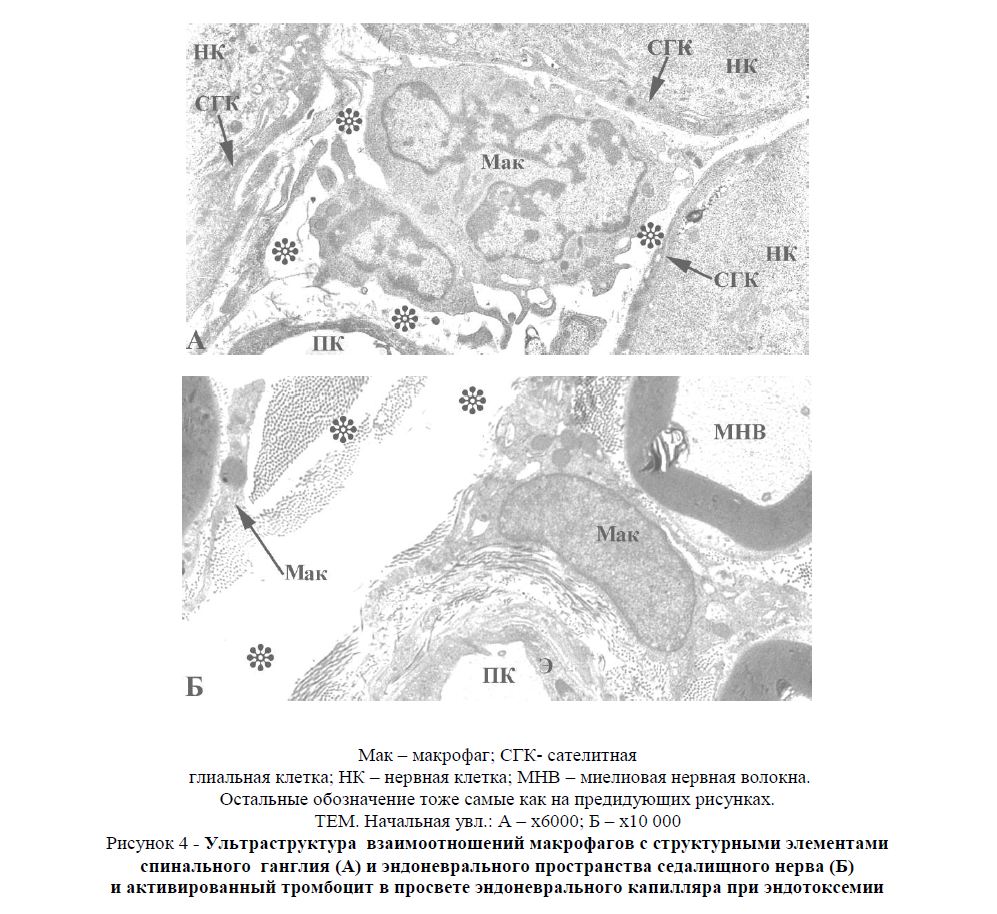  Ультраструктура взаимоотношений макрофагов с структурными элементами спинального ганглия (А) и эндоневрального пространства седалищного нерва (Б) и активированный тромбоцит в просвете эндоневрального капилляра при эндотоксемии 