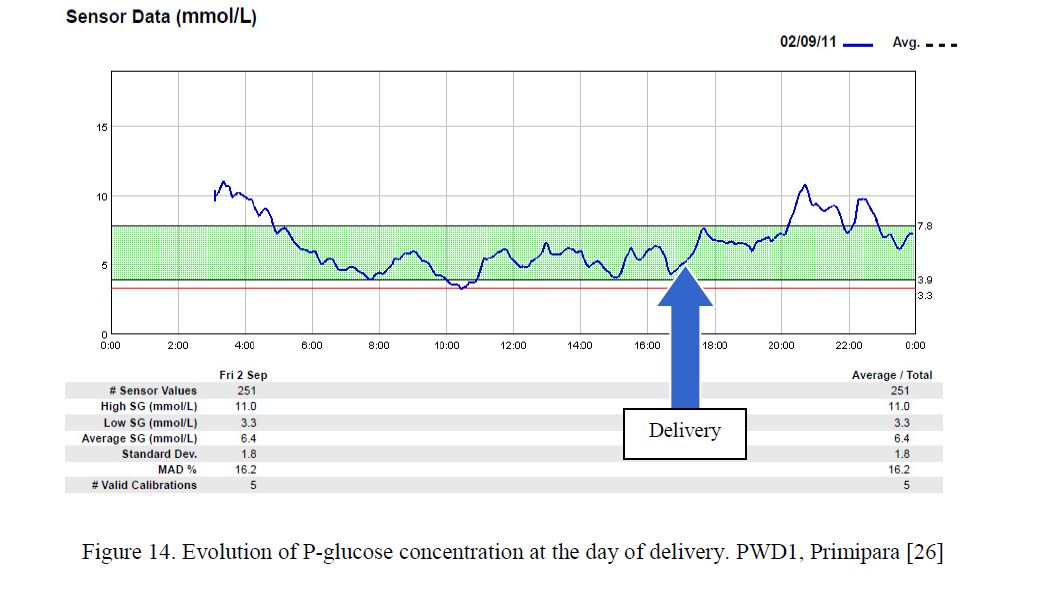 Evolution of P-glucose concentration at the day of delivery. PWD1, Primipara [26] 