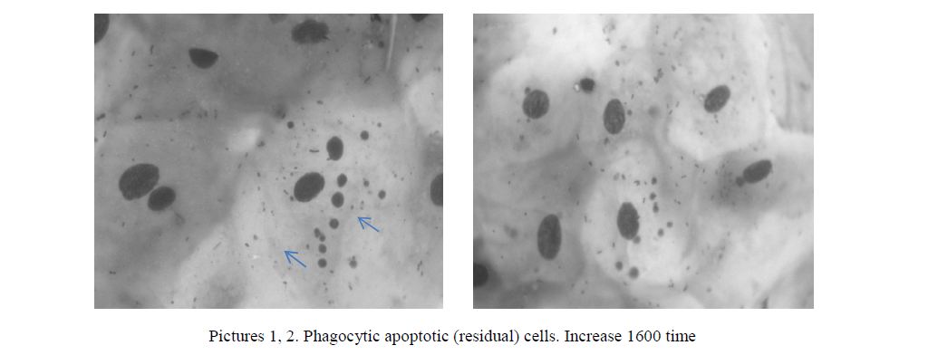 Phagocytic apoptotic (residual) cells. Increase 1600 time